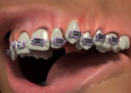 Orthodontics