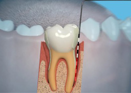 Periodontics