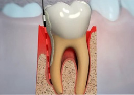 Periodontics